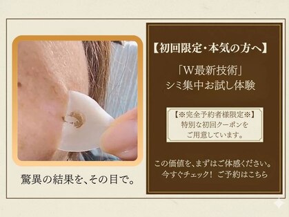 ジーニー(genie)の写真