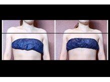 ナコズ エステティック(Nakos esthetic)/デコルテで印象変わります！