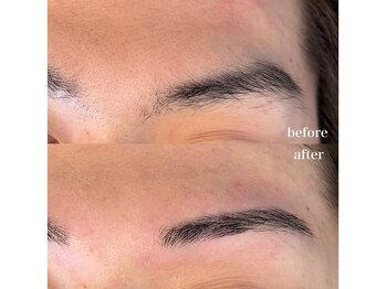 ダン(dan)/【WAX】症例