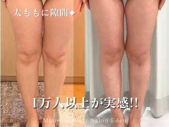 エデン(Eden)の写真/どこに行っても痩せられなかった方へ◆岩盤浴×１万人以上の体型変化に成功した究極筋膜リリースで美Bodyへ