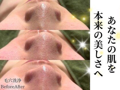 シンディー(CINDY)の写真