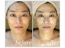 アン グレーヌ 自由が丘(unegraine)/左右バランスも整う！