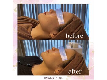 ウナ デ リンゴル 恵比寿店(UNA de Ringol)/フェイスラインが浮き出る!!