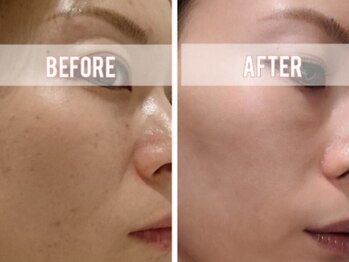 ブラン(BLANC)/【迷ったらコレ】オーダーメイド