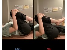 オンリーワン 整体院(Onlyone)/骨盤矯正で股関節の痛みが解消！