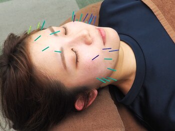 カラダシフト/高気圧酸素美容鍼