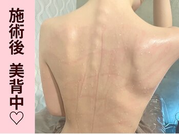 クイーンズチャーム(Queen's Charm)/パワーツリー★美背中