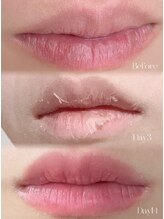 リュミエール デスポワール(Lumiere d'espoir)/ローマピンク