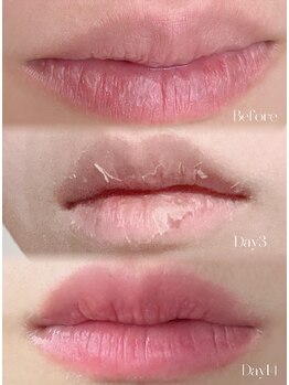 リュミエール デスポワール(Lumiere d'espoir)/ローマピンク