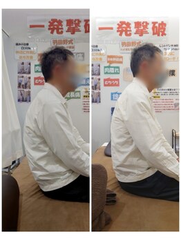 美波整体院 矢巾院/姿勢before→after