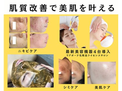 ユニクリア(Uni clear)の写真