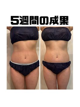 エバン 東銀座店(evan)/evanメソッド5週間