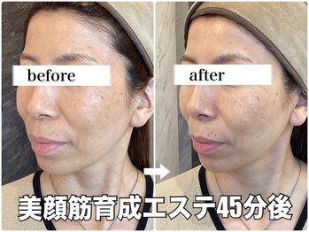 リエル(RIEL)/小顔矯正×美顔筋育成エステ