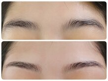 トータルビューティ ノイド(Noid)/眉WAX脱毛1回