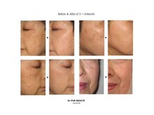 オトゥールボーテ(OToolBeaute)/