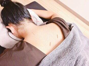 鍼灸マッサージここからの写真/【首肩こり・自律神経】国家資格保有者の鍼灸・指圧。お身体を深く整え、休める身体へ。90分