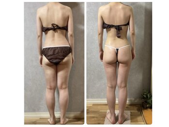 スリーピングビューティー(Sleeping Beauty)/