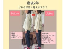 ルーナサナ(Luna sana)/産後骨盤矯正/姿勢の変化