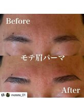 モテテ 池袋店(motete)/お客様施術例☆池袋 11