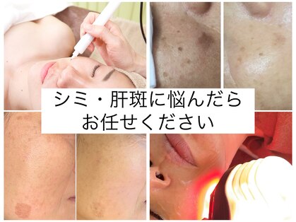 エクシア(ECXIA)の写真