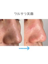 アクトウーマン(AKTWOMEN)/小鼻の角栓ケア