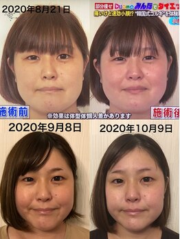 小顔堂 大阪心斎橋店/本場韓国小顔コルギ