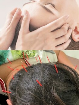 ヒューマン鍼灸接骨院の写真/【ドライヘッドスパ＋頭部鍼¥1980★】自律神経・脳疲労・疲労・ストレス・眼精疲労・頭痛のお悩みに