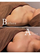 ロココ 水戸店(Rococo)/バストアップBefore &nbsp;After