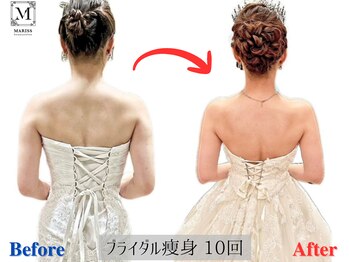 マリス(MARISS)/ブライダル痩身2ヶ月【痩身】