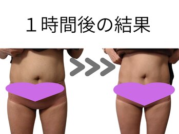 フロレゾン(Floraison)/脂肪分解ケア