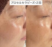【プロセルセラピーズ認定店 &nbsp;plage】毛穴ケア/育毛/更年期/デトックス