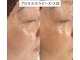 【プロセルセラピーズ認定店 plage】毛穴ケア/育毛/更年期/デトックスの写真