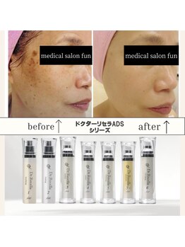 メディカルサロン ファン(FUN)/四条烏丸の好立地！