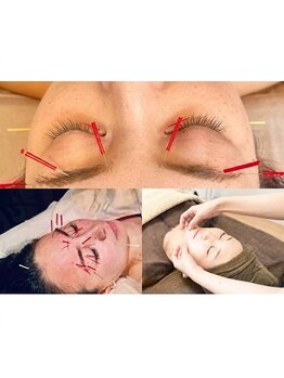 フェリース鍼灸院の写真/美容鍼と首肩デコルテケアで、目元のクマ・たるみ・首肩こりを同時に整え、明るく軽やかな印象へ導きます。