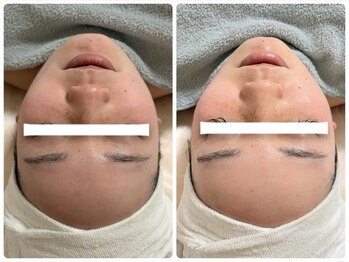 エテルナ(ETERNA)の写真/リフトアップ施術×マッサージで小顔に【低価格&通いやすさ】を実現した完全プライベートサロンです**
