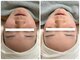 エテルナ(ETERNA)の写真/リフトアップ施術×マッサージで小顔に【低価格&通いやすさ】を実現した完全プライベートサロンです**