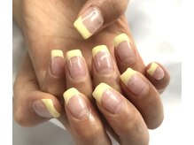 ケーエヌ(KN)/イエローフレンチ