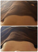 セラフ(Seraph)/バスト