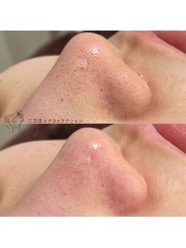 ジュメイラ(Jumeirah)/二刀流エクストラクション！