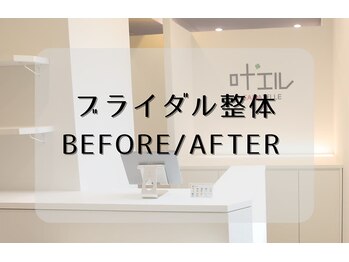 叶'エル 本町 心斎橋院/ブライダルビフォーアフター画像