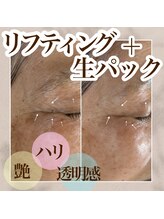 ミュウ(miuex)/目尻に注目！