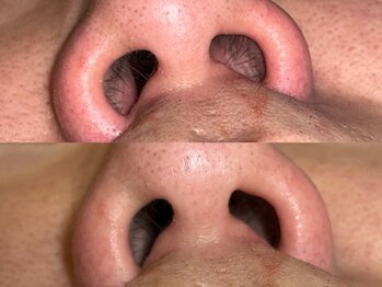 クラウン 心斎橋店(CROWN)/