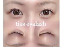 タイズ ヘアーリムーバルアンドアイラッシュ(ties)/施術実績★
