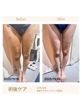 ウェルネス アンド 健康体験サロン/術後ケア・拘縮を緩和◎