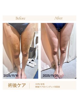 ウェルネス アンド 健康体験サロン/術後ケア・拘縮を緩和◎