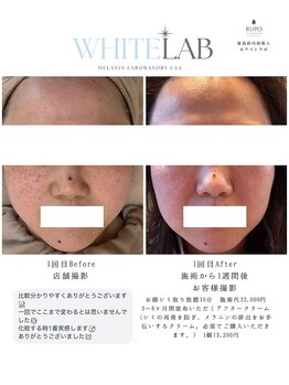 ルポザメンテナンス 長岡店(RUPO THE MAINTENANCE)/シミケア　ホワイトラボ