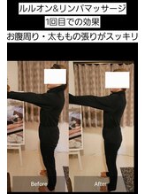 ヨサパーク ライズ 大日(YOSA PARK RISE)/BeforeAfter 