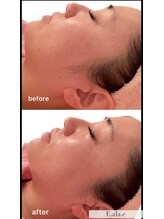 エ アラ エ(E.ala.e)/3周年特別キャンペーン