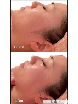 エ アラ エ(E.ala.e)/3周年特別キャンペーン