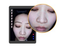 毛穴ラボ 柏(毛穴LABO)/毛穴専門店l LABO柏|肌診断機